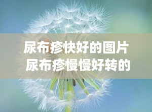 尿布疹快好的图片 尿布疹慢慢好转的表现