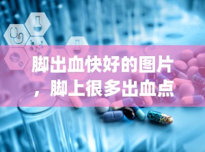 脚出血快好的图片，脚上很多出血点怎么回事