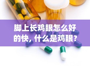 脚上长鸡眼怎么好的快, 什么是鸡眼？