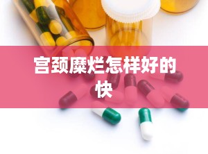 宫颈糜烂怎样好的快