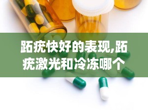 跖疣快好的表现,跖疣激光和冷冻哪个效果好