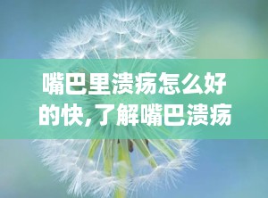 嘴巴里溃疡怎么好的快,了解嘴巴溃疡