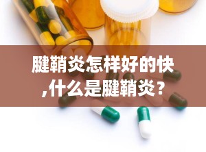 腱鞘炎怎样好的快,什么是腱鞘炎？