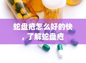 蛇盘疮怎么好的快, 了解蛇盘疮