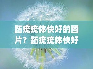 跖疣疣体快好的图片？跖疣疣体快好的图片女性