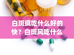 白斑疯吃什么好的快？白斑风吃什么药好