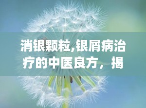 消银颗粒,银屑病治疗的中医良方，揭秘其药理作用与临床应用