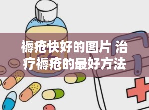 褥疮快好的图片 治疗褥疮的最好方法